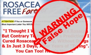 false Hope rosacea cures and remidies