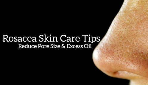 Treating Enlarged Pores And Excess Facial Oil Caused By Rosacea
