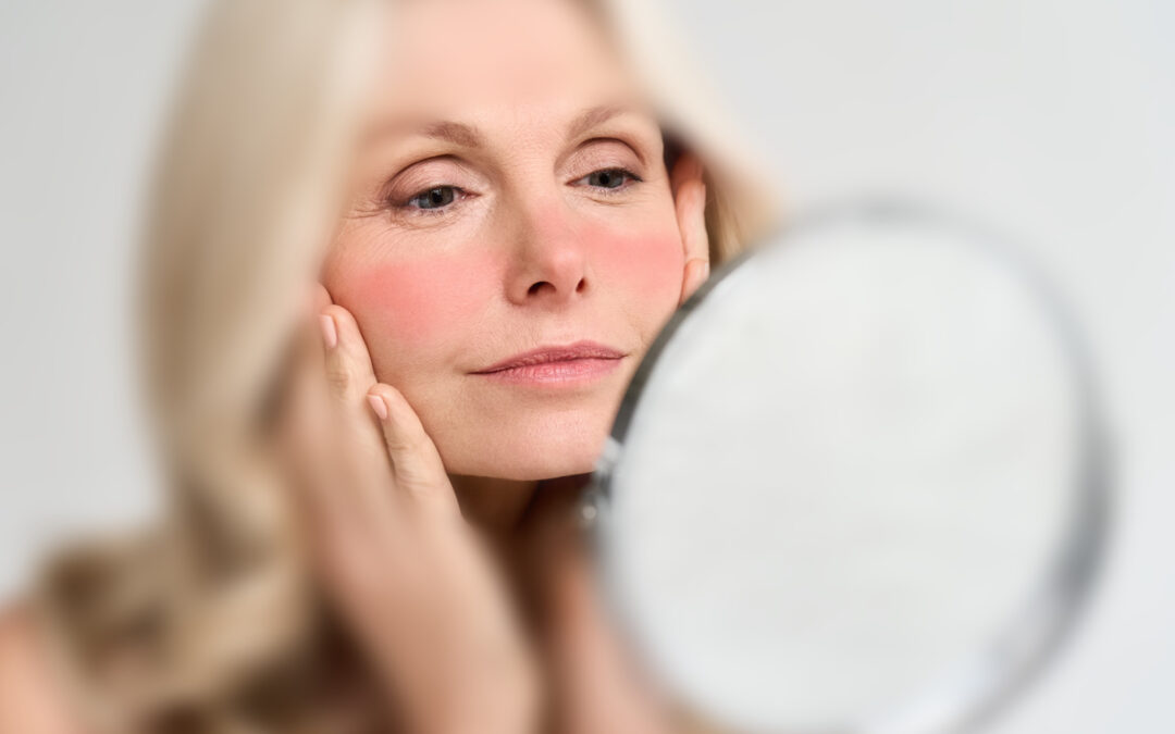 woman looking in mirror observing her Rosacea triggered by menopause